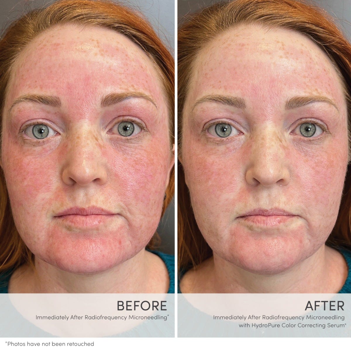 HydroPure Color Correcting Serum