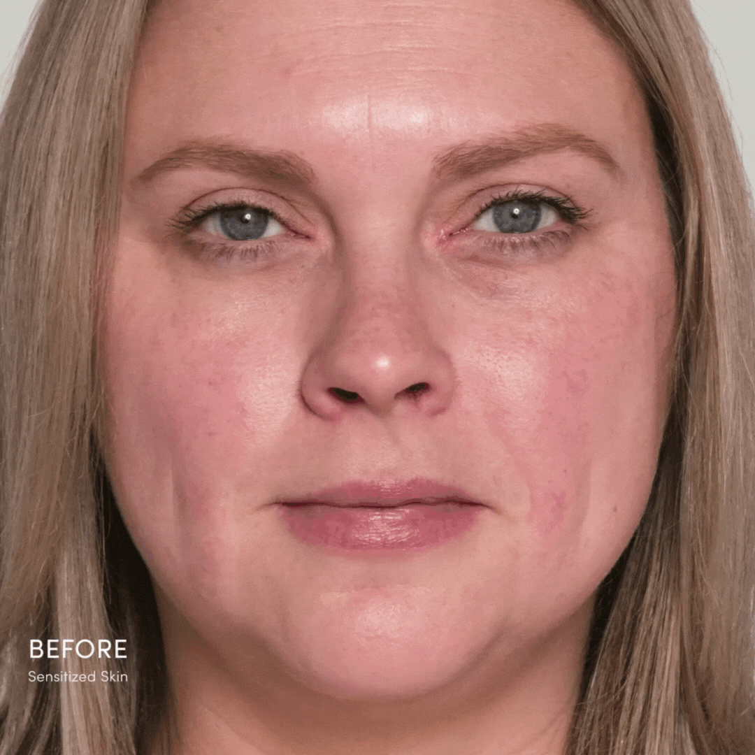 HydroPure Color Correcting Serum