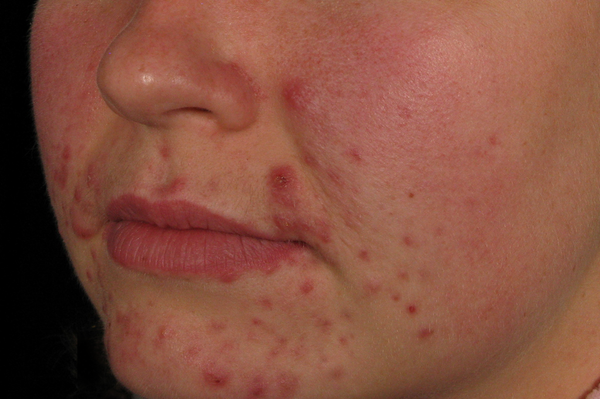 After Environ
