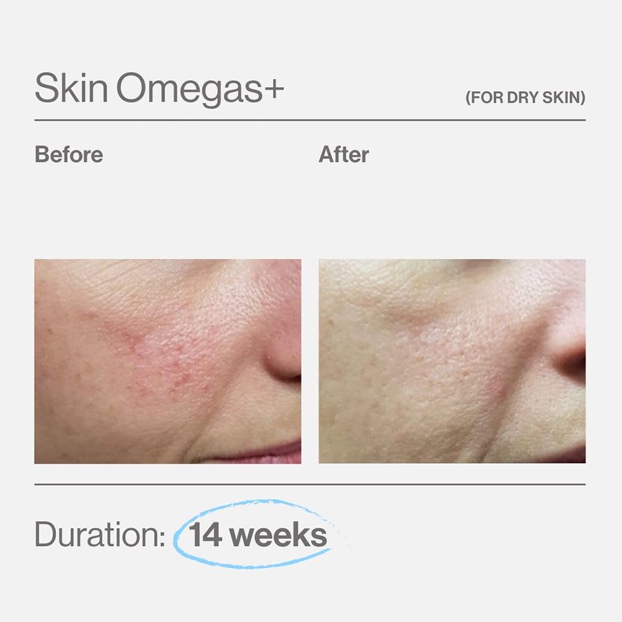 Advanced Nutrition Programme Skin Omegas brand-supplied before and after image