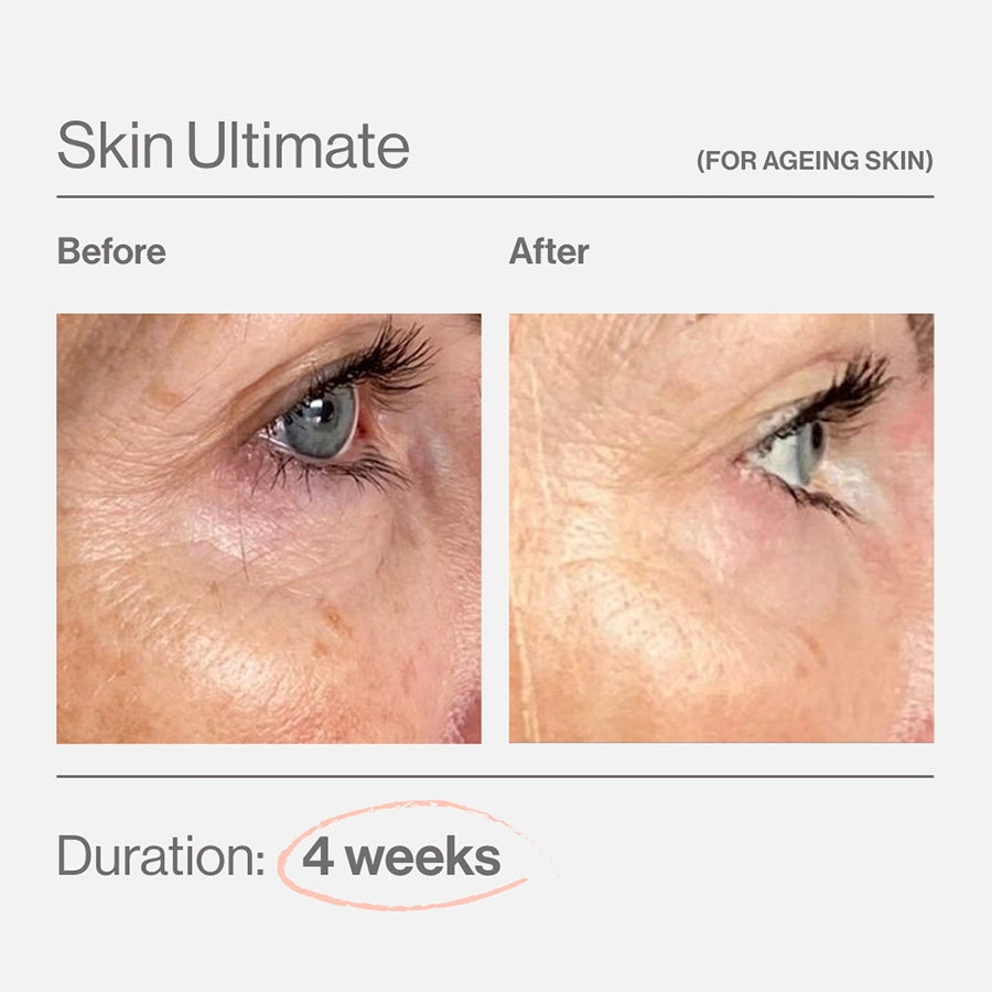 Advanced Nutrition Programme Skin Ultimate brand-supplied before and after image