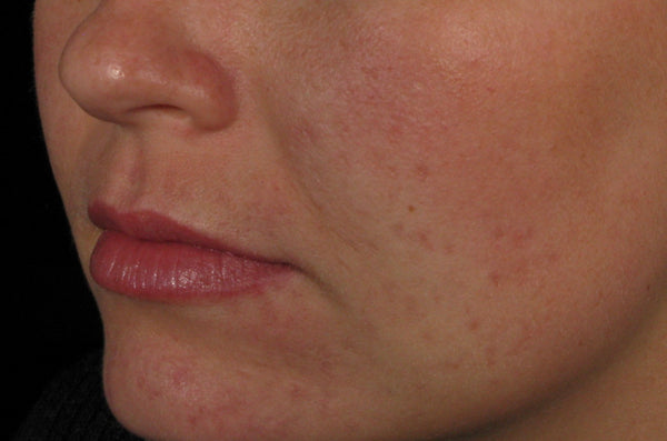 Before Environ